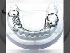 Sistema de exploración intraoral dental dental de la proyección de imagen del puente 3D Digitaces del laboratorio PFM de la dentadura