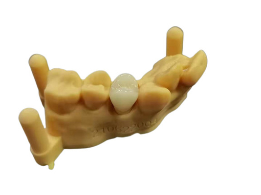 OEM 3D que imprime el diseño dental de Digitaces del laboratorio de la dentadura de acrílico flexible