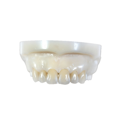 Coronas y puentes de dientes totalmente cerámicos de zirconia