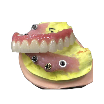 Corona dental de la circona del contrafuerte del implante natural todo en cuatro dentaduras
