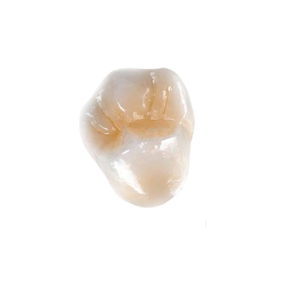 Chapee ultra difícilmente las dentaduras de pulido del implante de la corona totalmente de cerámica dentales