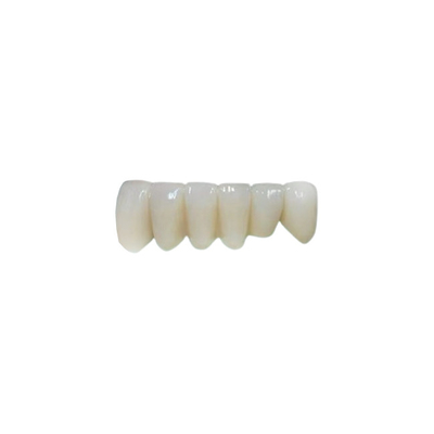 OEM Implante de zirconía de corona dental puente fijo