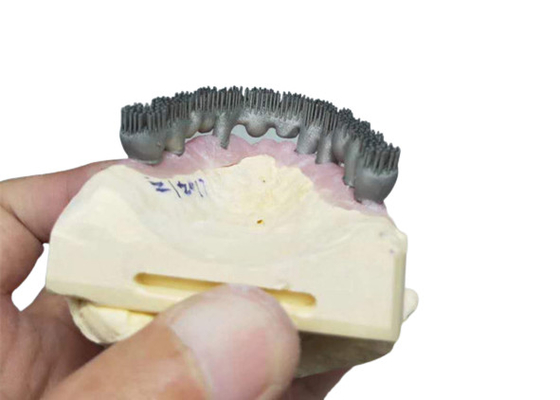 Impresora durable Dental Lab Prints de la leva PFM 3D del cad para la investigación