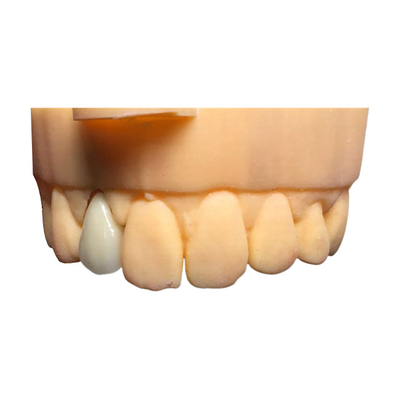 Puente dental buen Biocompatibility de la corona de la seguridad PFM de Chromecast