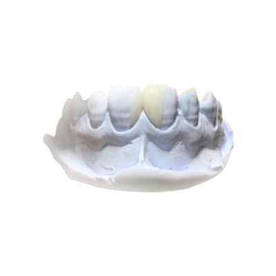 Materiales dentales desprendibles de la salud de la corona de la resina eficiente PFM