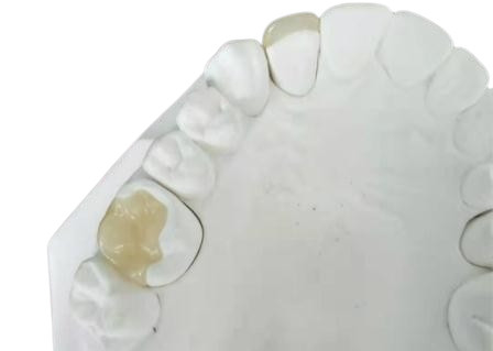 Corona flexible durable IPS dental E Max Press Inlay Onlay del puente de PFM