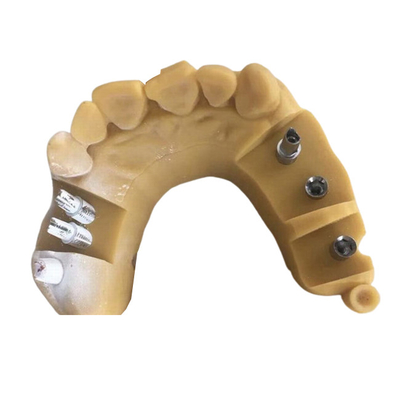 Corona dental 3D de Digitaces Biocompatibility PFM que imprime las coronas temporales