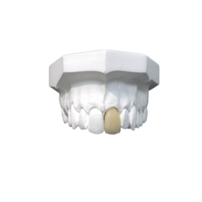 Material biológico de High Tech de la buena de Biocompatibility corona dental de la porcelana