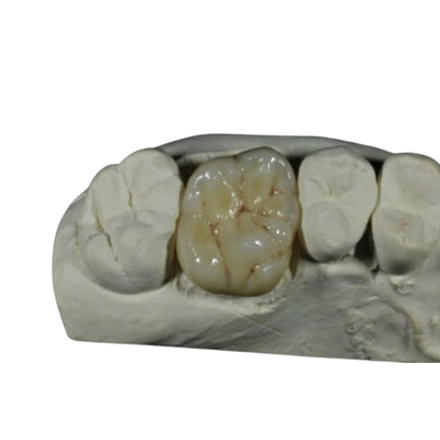 Corona dental de la porcelana flexible del CE ISO para la restauración de los dientes traseros