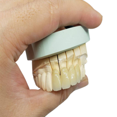 Corona resistente a la corrosión de la porcelana del OEM de la seguridad toda la mirada natural de cerámica