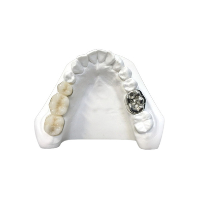 Alta densidad dental de la seguridad de la salud de la corona de la porcelana ultra dura de Digitaces