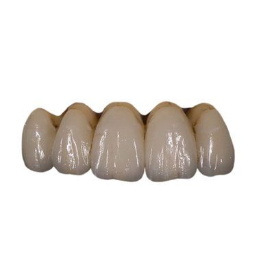 Fácil mantenga la estabilidad del color dental de la corona de la porcelana ortodóntica de PFM