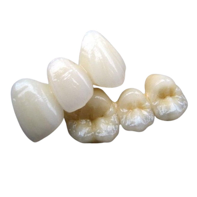 Estabilidad del color de encargo del puente dental de cerámica del Cr 3014652903 de PFM Co