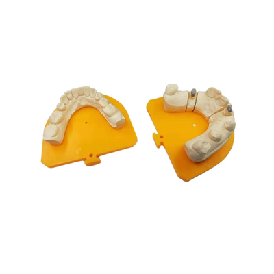 Corona de cerámica dental de la corona PFM de la porcelana de alta resistencia del oro amarillo
