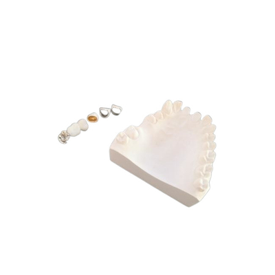 Resistencia a la corrosión completa modificada para requisitos particulares del metal de la corona dental de la porcelana de PFM