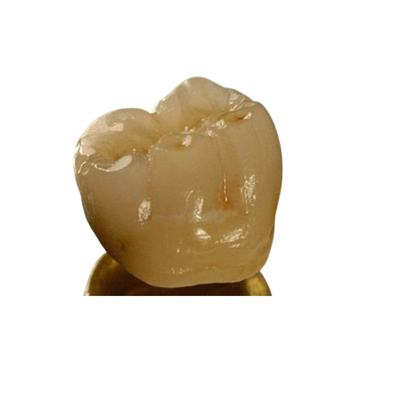 Corona dental de la porcelana inter de la miscibilidad