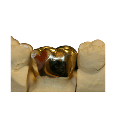 Laboratorio dental de la protección FMC del puente fino de alta densidad de la corona
