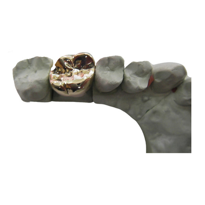 Material biológico de High Tech del metal PFM del puente dental lleno de la corona