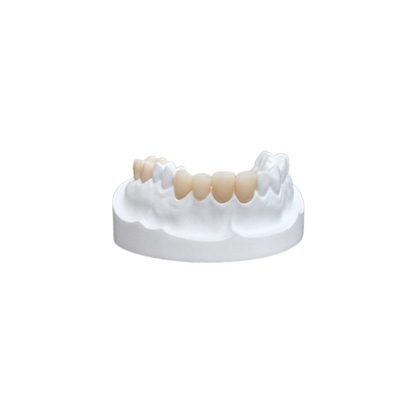 Chapa fuerte de la corona dental de cerámica de los sobrepuestos de los embutidos para el departamento dental