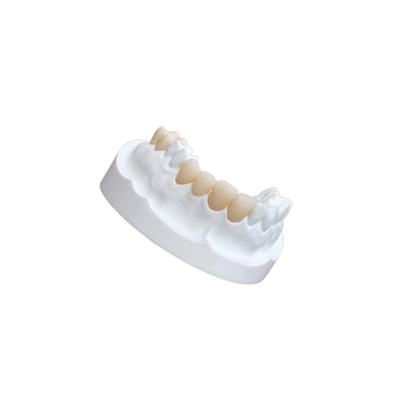Chapas compuestas de la porcelana del IPS E Max Ceramic Dental Crown Comfortable
