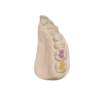 Corona totalmente de cerámica dental de encargo de alta densidad de encargo de la cerámica FDA