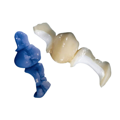 OEM modificado para requisitos particulares que pule el sobrepuesto dental totalmente de cerámica del embutido de la chapa de la corona