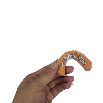 3D que imprime los modelos dentales desprendibles del marco de la corona para la odontología