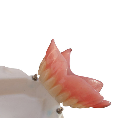 Alto implante de la dentadura CAD-CAM del accesorio de la precisión de Biocompatibility