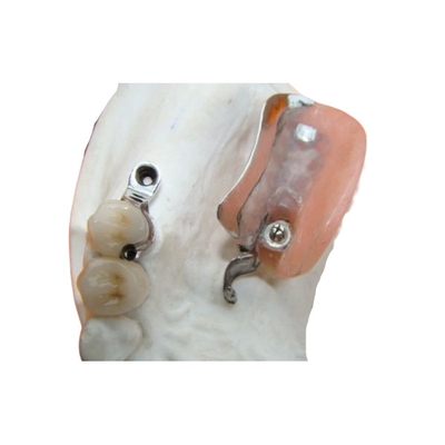 La dentadura duradera del accesorio de la precisión del laboratorio dental mancha resistente