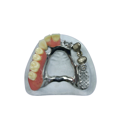 Hermosa apariencia Apego de precisión Dentadura Apego de implantes