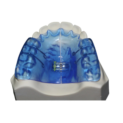 Instrumentos dentales ortopédicos con alta estabilidad y buen Biocompatibility