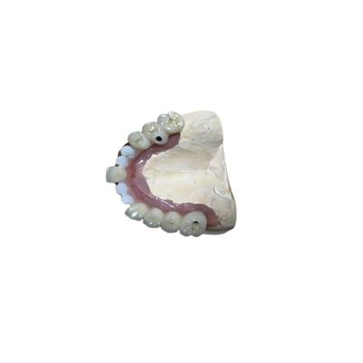Corona exacta del implante del diente de los accesorios del implante dental de Biocompatibility