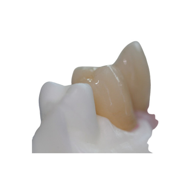 Contrafuerte de encargo del titanio de la barra pura desprendible del implante dental