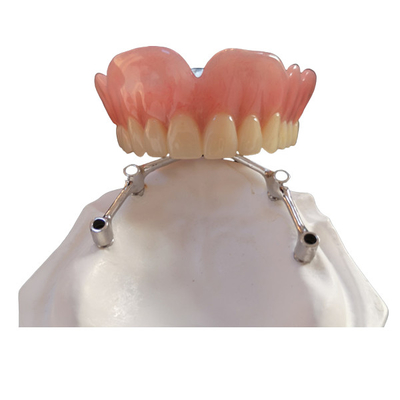 Implantes dentales de la corona FDA del implante del diente de COCR con la barra del titanio