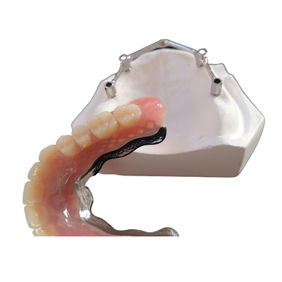Barras de implantes dentales de titanio/titanio puro para el centro digital CAD CAM