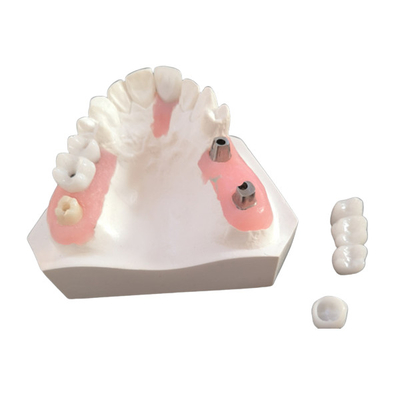 Buena barra inter biológica del implante dental de la miscibilidad con la aprobación del FDA