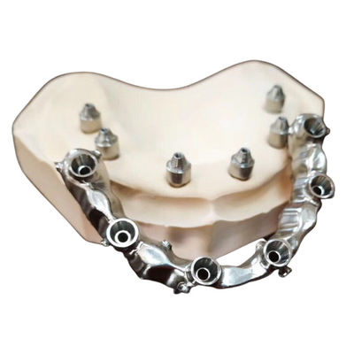 Fuerte altamente estético dental del puente del FDA 3014652903 PFM extremadamente