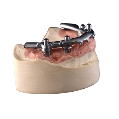 El implante del CNC del titanio All-On-4 aseguró las dentaduras para la clínica dental