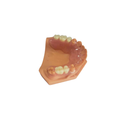 3D imprimió las dentaduras para los laboratorios dentales basados en los datos de Digitaces