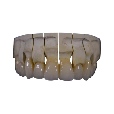 La circona dental de la restauración de la corona de la circona llena de la boca fijó resistencia química del puente