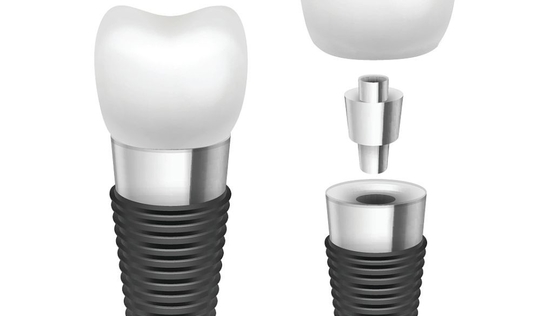 Implante dental Rod Comfortable Highly Biocompatible Implant del cromo del titanio/del cobalto