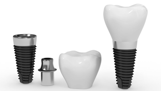 Barra natural larga del implante dental de la vida de servicio del implante artificial confiable seguro de la raíz