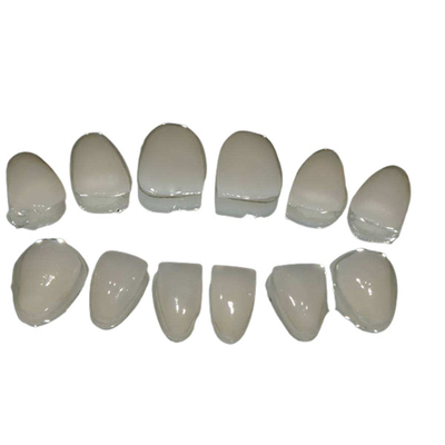 Limpieza fácil de los dientes de cerámica de la chapa del arreglo para requisitos particulares para la sonrisa confiada