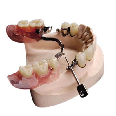 Resistente a la corrosión natural hermoso de la dentadura del accesorio de la precisión Mk1