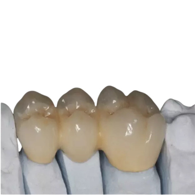 El OEM modificó el artículo de alta resistencia de los dientes para requisitos particulares de la porcelana de la circona hermoso