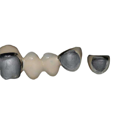 Resistente a la corrosión estupendo del cobalto de Chrome de la aleación de los dientes naturales de la porcelana
