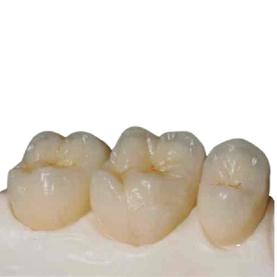 Precisión de cerámica Digital de los dientes de la circona de alta resistencia manufacturada