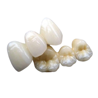Estabilidad fuerte del diente de la corona del puente de la porcelana ningunos sensación del cuerpo extraño