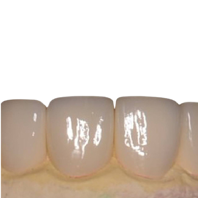 Los dientes lisos de la porcelana no chapean ninguna chapa blanca hermosa de la porcelana de la irritación