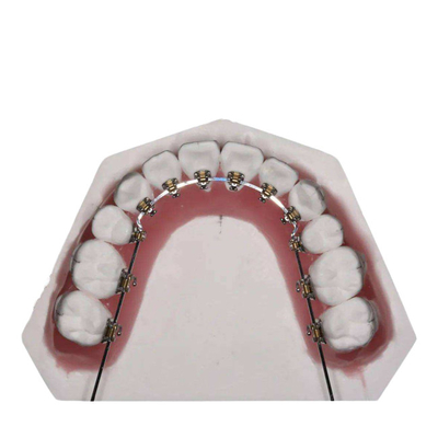 El alambre recto fijó los dispositivos ortodónticos para enderezarse de los dientes